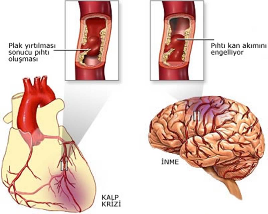 Bu besinler kalp krizi riskini 3 kat artırıyor! Uzmanlardan altın değerinde 'kalp sağlığı' tavsiyeleri 8